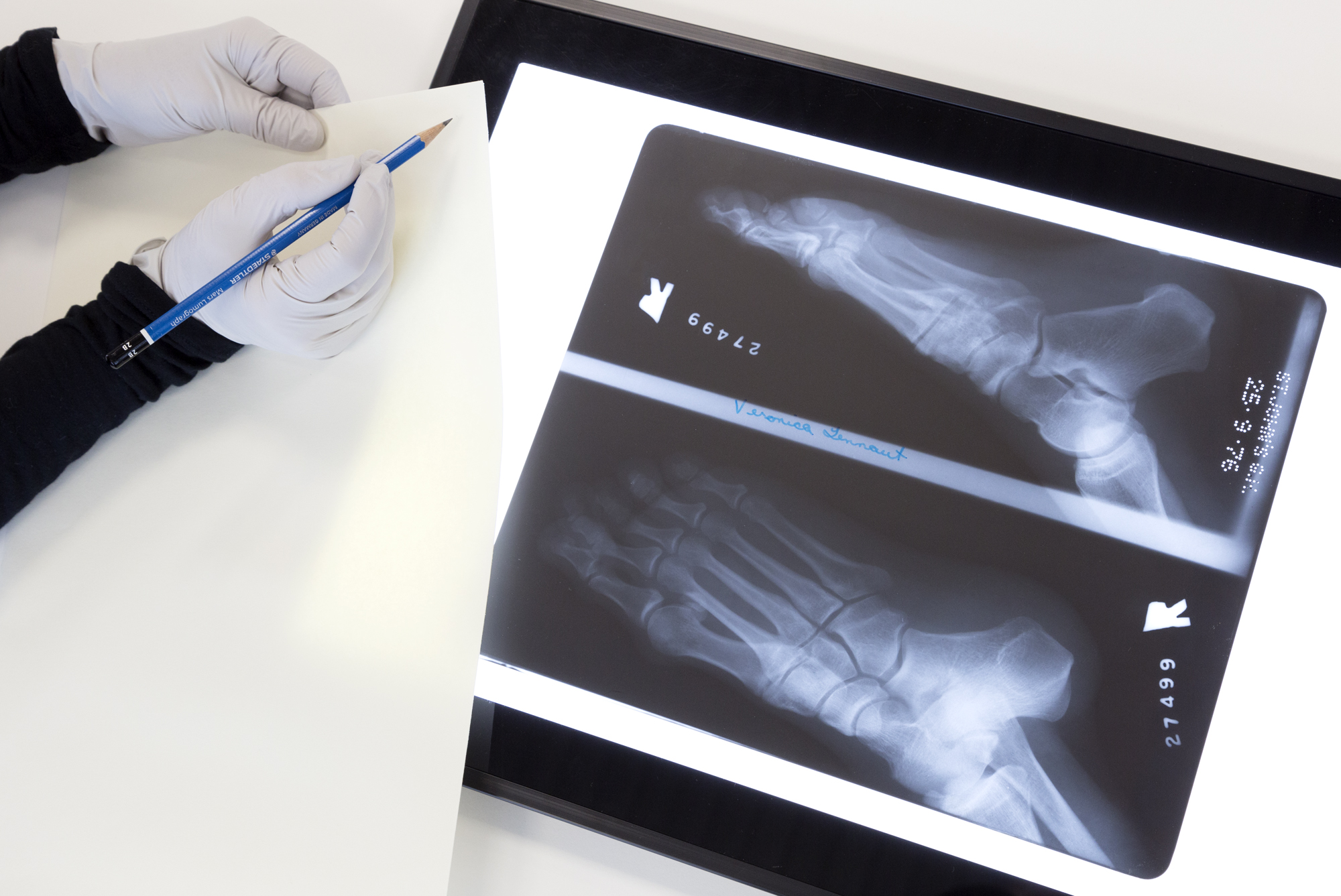 An archivist writing with a pencil on an envelope beside two x-rays of someone’s feet.